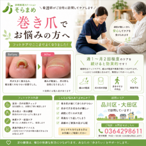 巻き爪でお悩みの方へ｜ご自宅で受けられるフットケア